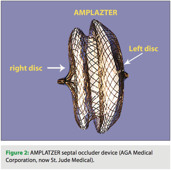Ablation of Atrial Fibrillation in a Patient with a Percutaneous Septal